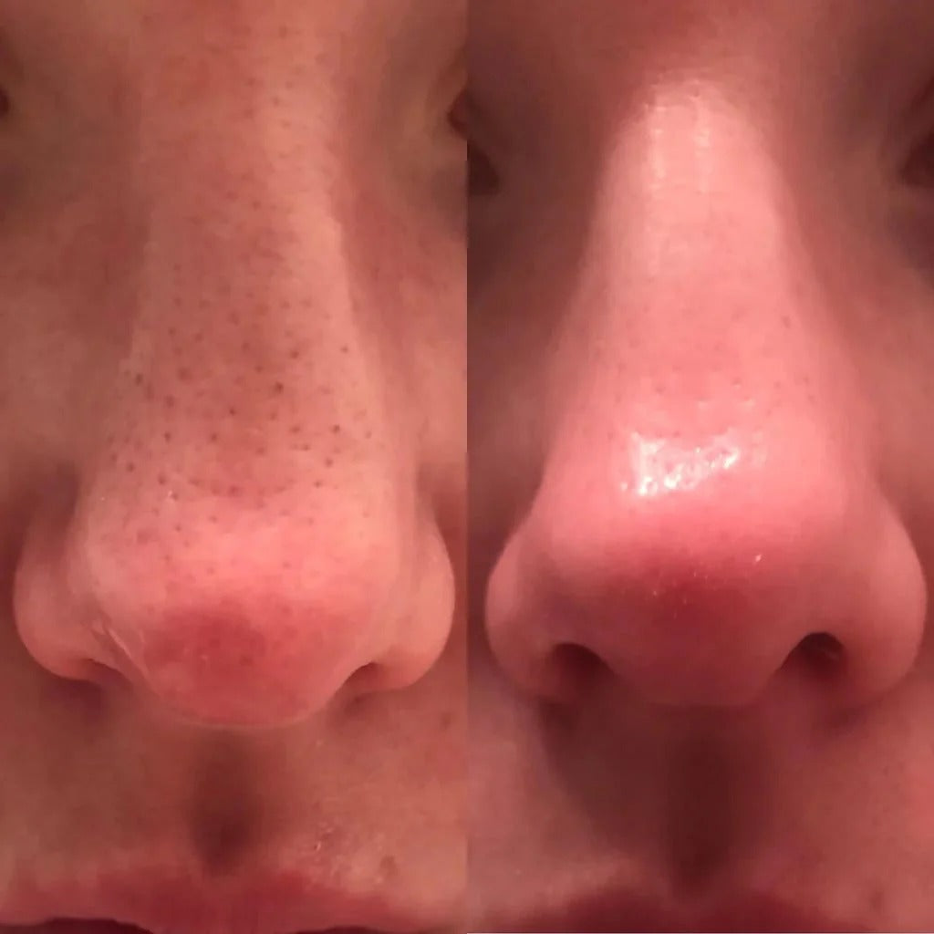 Glass Skin Essential Kit (5 pcs)